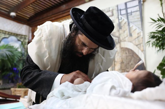 Моэль проводит процедуру обрезания.